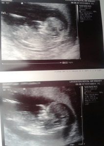 Early scan photo of my twins; November 2011.